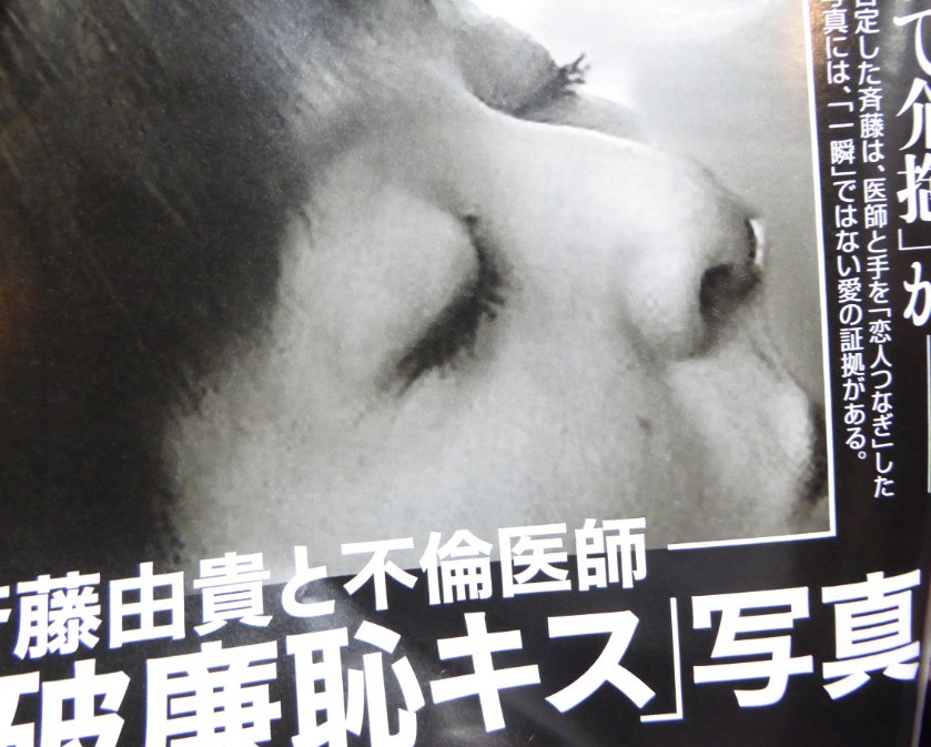 斉藤由貴のキス写真 フラッシュ をチェック 医師の画像と名前を調べてみた